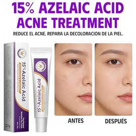 Ácido Azelaico Suero Facial al 15%, Crema Hidratante Facial, Reduce Rojeces e Imperfecciones, Rejuvenece la Piel (20g*3)