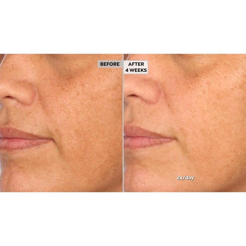 NassifMD Hydro-Screen Serum 4 oz Pump Bottle Hyaluronic Acid Retinol