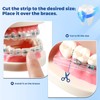 B Rush Comfort Cover for Braces -Orthodontic Lip Bumper, Lip