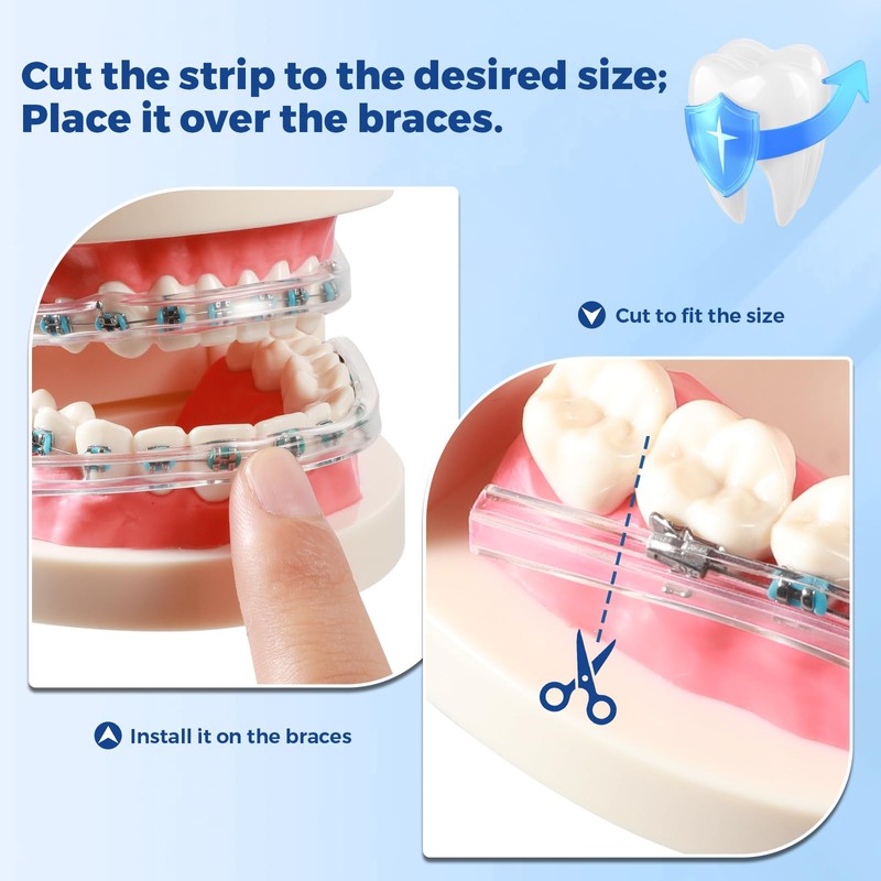 B Rush Comfort Cover for Braces -Orthodontic Lip Bumper, Lip