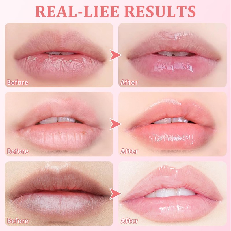 5 PCS Honey Pot Bee Lip Balm (honey,Strawberry, Watermelon, Apple,Cherry),