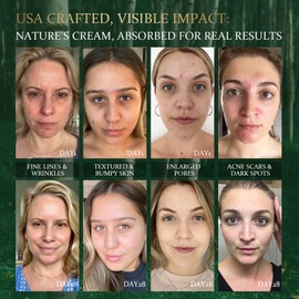 HOLYOM Anti-Aging Face Moisturizer - Daily Hydration Moisturizer, Firming,Hydrate Natural Formula for Wrinkles & Fine Lines Facial Moisturizing 1.75 Fl Oz