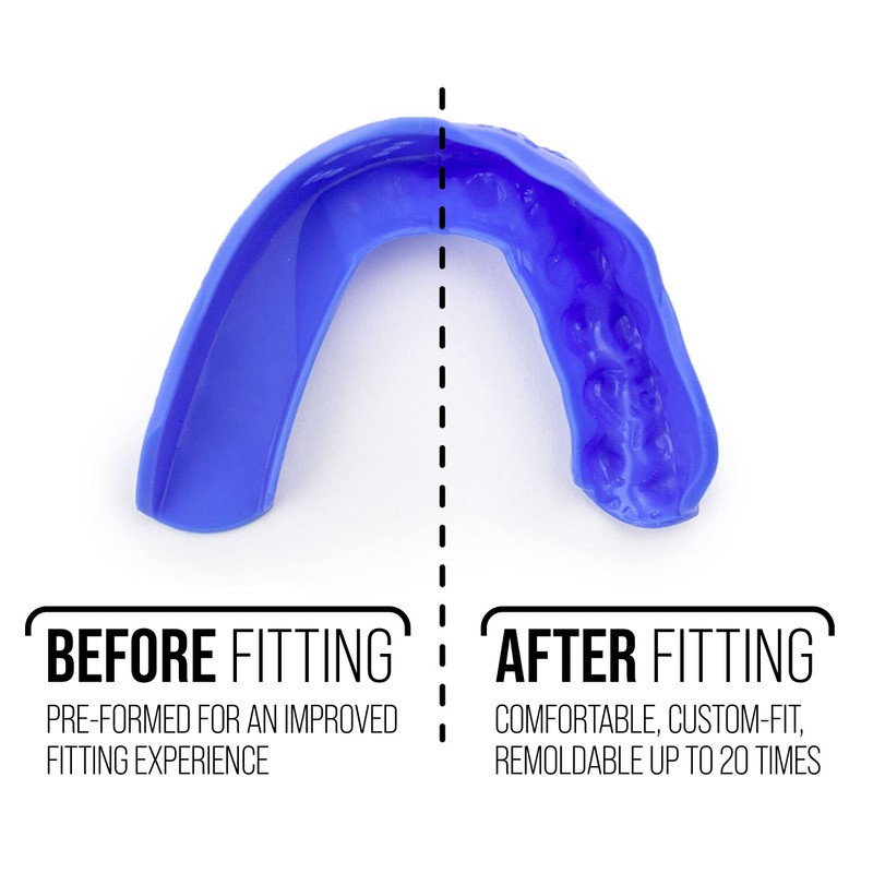 Forest Green SISU 3D Adult Mouth Guard