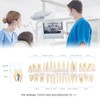 MediTrainer Dental Model Teeth Model, 28 Pieces of Two-Color Permanent
