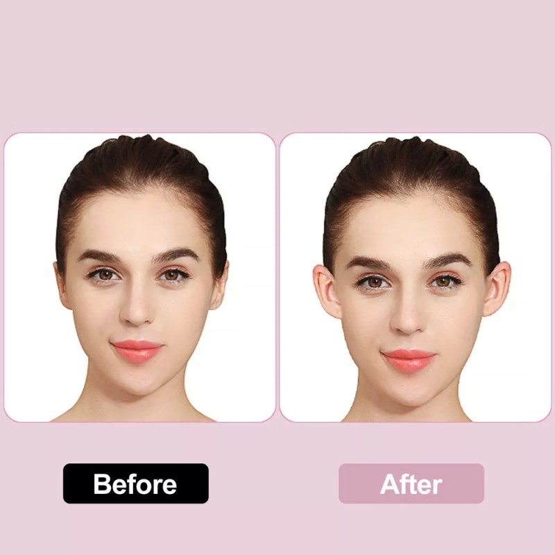 Corrector De Orejas Beauty Lug Solutions Gen - Adhesivos Par