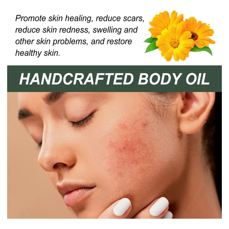 Pures Caléndula Para El Cuerpo Hecho A Mano, 30 Ml