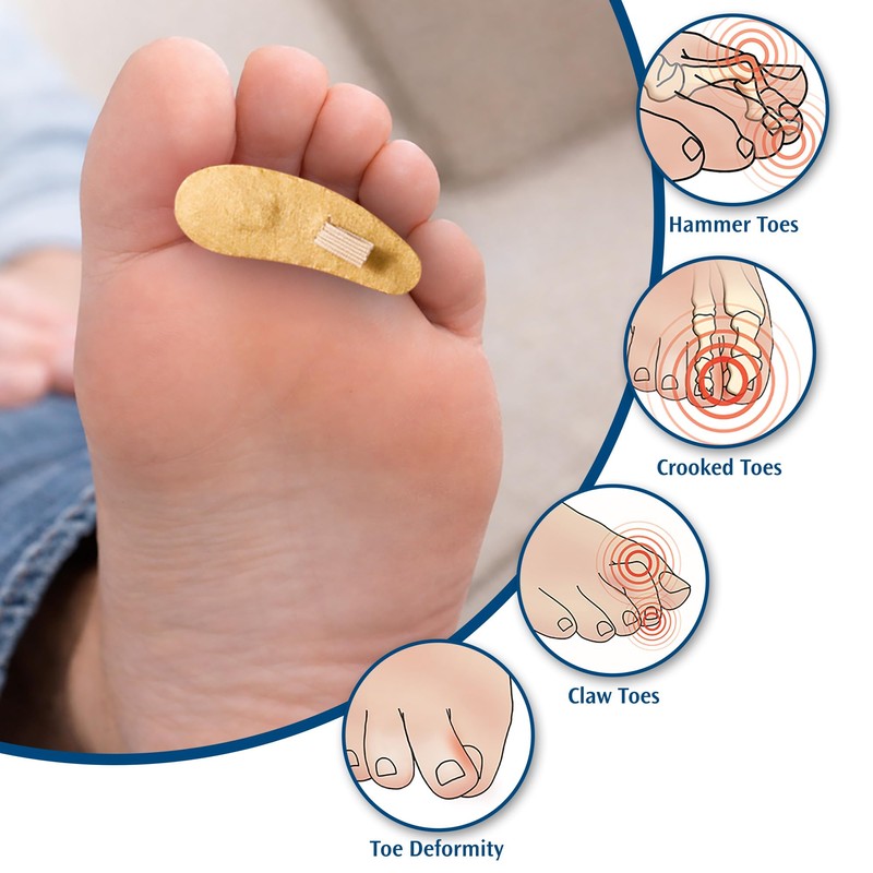 PediFix Felt Toe Crest Cushion with Loop – Hammer Toe