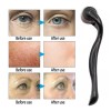 Didier Market Dermaroller Facial Barba Produce Colágeno Elimina Arrugas