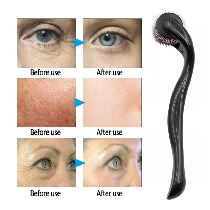 Didier Market Dermaroller Facial Barba Produce Colágeno Elimina Arrugas