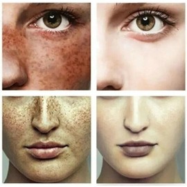 ENVISHA Dark Spot Corrector Hyaluronic Acid Vitamin C E face anti-aging Skin Cream 1.7