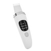 Face Skin Scrubber Vibration Face Peeling Machine Ultrasonic Exfoliating Skin‑Care