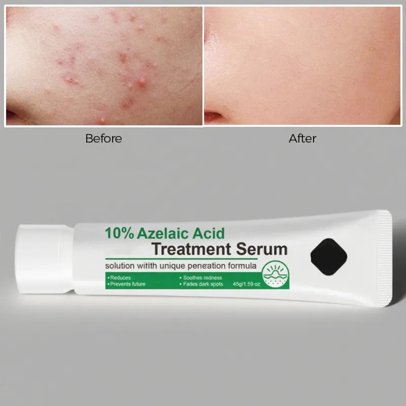 Srum Facial Azelaic 12 45 G Para El Cuidado De