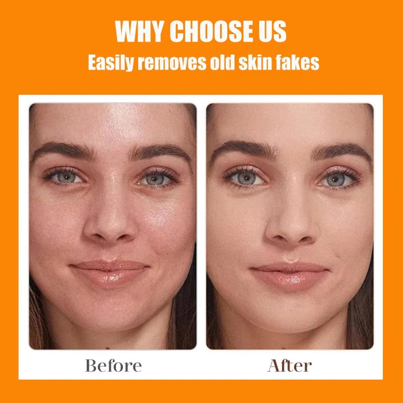 Gel Exfoliante Facial, Exfoliante Facial Hidratante Con Enzi