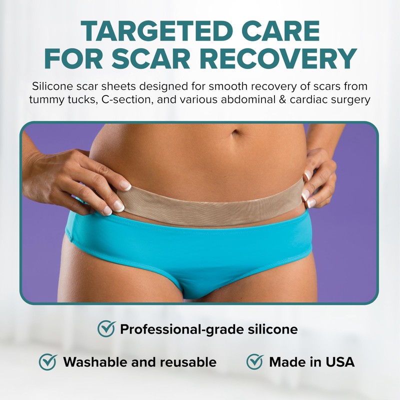 EpiDerm Long Strips Natural Silicone Scar Sheets – Soft, Flexible