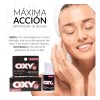 Oxy 10 Para Barros Y Espinillas Color Piel 30g Piel