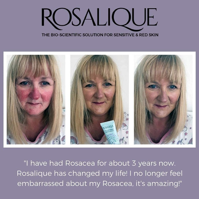 Rosalique 3 in 1 Anti-Redness Miracle Formula SPF50 1 x