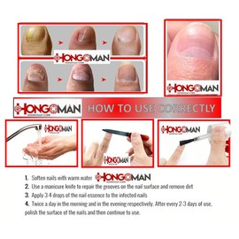 HONGOSAN NAIL and Skin toenail Athlete's Foot Treatment Rash Athletes Foot Skin and Nails HONGOS Nail Solution