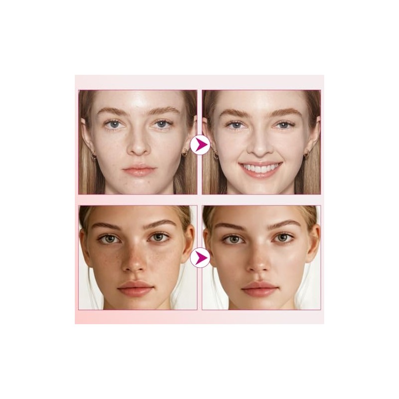 Arbutin 7.0 + TXA 4.0 Cremas Manchas Faciales, Reduce la