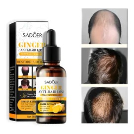 Serum Gengibre Reparador Capilar Crecimiento Anticaida 30ml                                                                                           