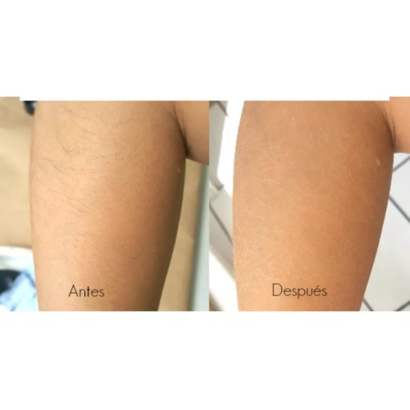 Nefertiti Aclarador De Vello Facial Y Corporal Aclaran-t 3pz