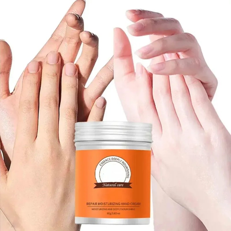 Wx 2. La Crema De Manos Para Callos Restaura La