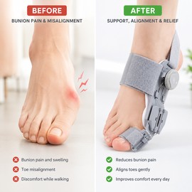 Adjustable Bunion Corrector for Big Toe Alignment – Rotatable Toe Straightener Splint for Home and Daily Foot Care
