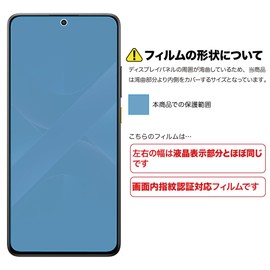 ASDEC NSE-MIPX7P-Z POCO X7 Pro Anti-Glare Anti-Glare Film, Anti-Glare Film, Anti-Glare, Matte Made in Japan, Anti-Glare, Anti-Fingerprint, Anti-Glare