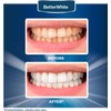 BetterWhite Professional Teeth Whitening Strips 7 Treatments - Enamel Safe