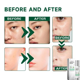 50ml Centella Asiatica Hydrating Serum,Anti-Aging Face Serum,Skincare Serum,Hyaluronic Acid Serum,Face Serum for Women with Hyaluronic Acid,Anti Wrinkle Face Cream,Serums Skincare,Facial Moisturiser