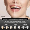 Pack of 28 teeth whitening strips, whitening teeth, white stripes