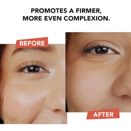 Beauty by Earth Hyperactive Anti Aging Vitamin C Face Cream - Made in USA with Natural & Organic Ingredients, Face Moisturizer for Women & Men, Day & Night Cream, Anti Wrinkle Face Skin Lotion