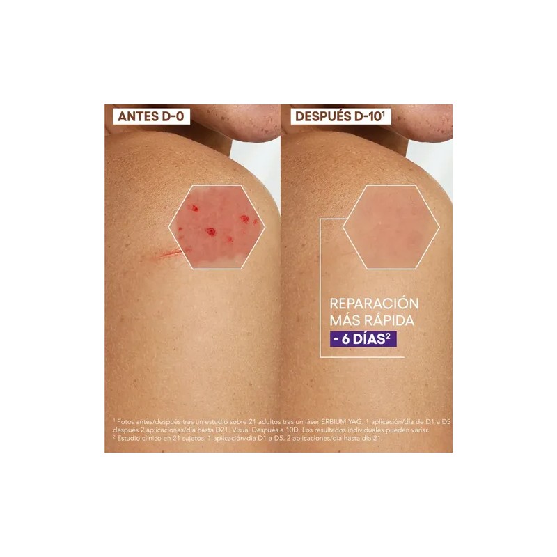 Crema A-Derma Epitheliale Ultra Repair Reparadora de Noche para Cicatrices