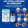 Líquido Mejorador De Verrugas Y Maíz Reva
