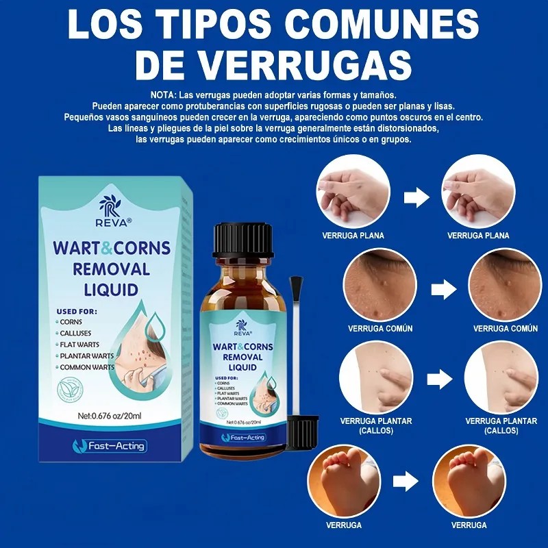 Líquido Mejorador De Verrugas Y Maíz Reva