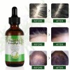 Pelo Aceite De Romero Para El Crecimiento Del Cabello, Suero