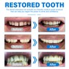 Tooth Filling Repair Kit, Temporary Fixing, Regain Confidence Smile, for
