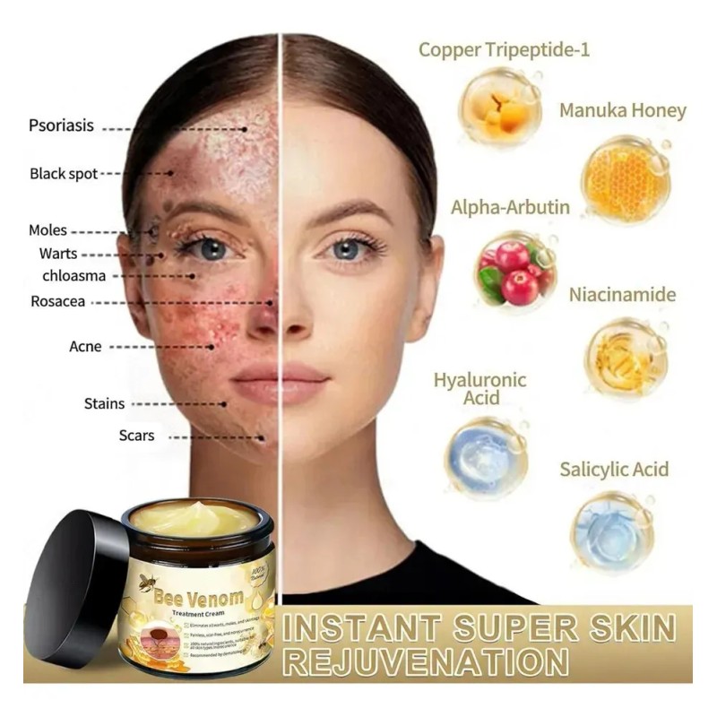 Crema De Tratamiento Para La Piel Hy Bee, Para Todas