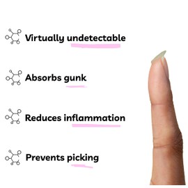 Spot Stoppers Pimple Patches - Invisible Spot Patches for Acne Treatment, Hydrocolloid Patches for Spot Treatment, Vegan & Cruelty Free Korean Skincare (30 Count (Pack of 1))