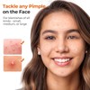 443 Pimple Patches for Face – Hydrocolloid Acne Patch Set