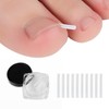 Ingrown Toenail Corrector Band & Wire Tips (10-Pack) Ingrown Toenail Correction Tips (10-Pack) 8ea