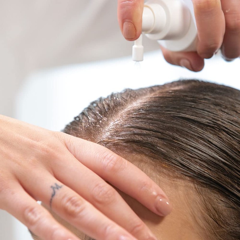 RE/START Hydration Scalp Moisturising Lotion, 100 ml, Moisturising Against Dry
