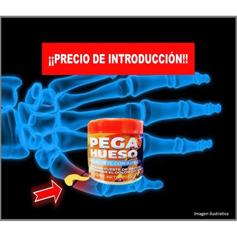 Gel Para Cuerpo Pega Hueso Golpe,dolor Crónico Árnica Alivio