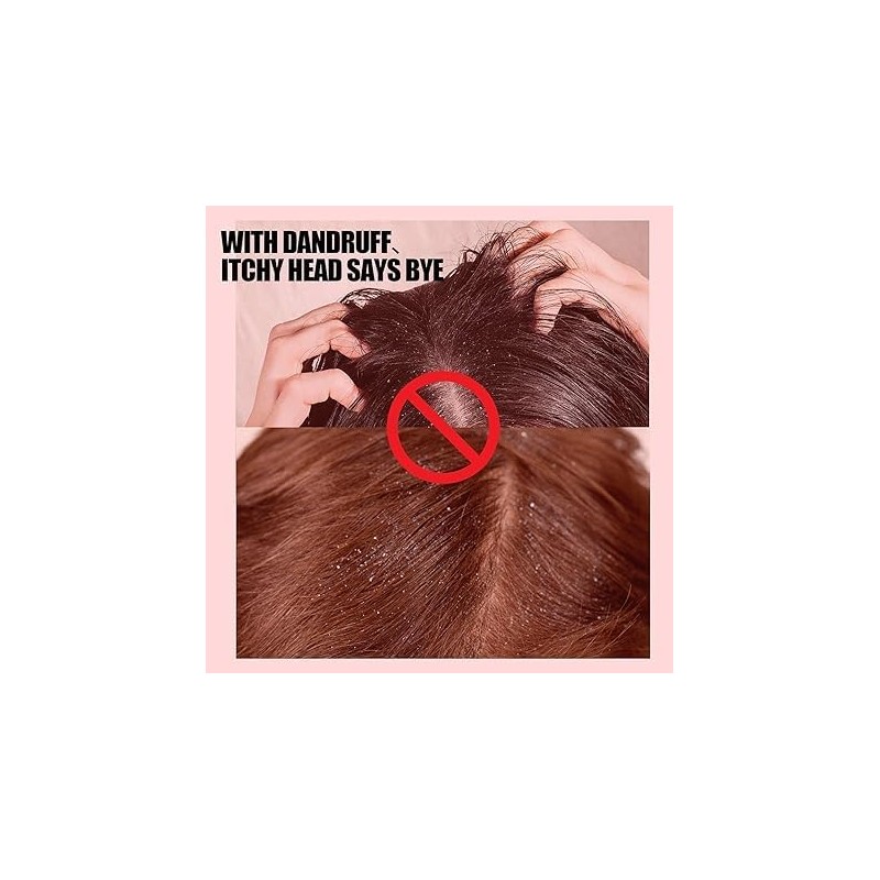 Sulfur Medicated Anti-Dandruff Conditioner for Braids, 356 ml
