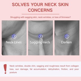 Retinol Firming Neck Cream, Collagen Neck Creams for Tightening and Firming, Neck & Shoulder and Chest Firming Cream with Roller, Skin Care for Sagging Skin, Reduce Wrinkles Fine Lines & Double Chin