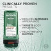 L'Oréal Men Expert Derma Control Anti-Blemish Shower Gel. Prevents Spots