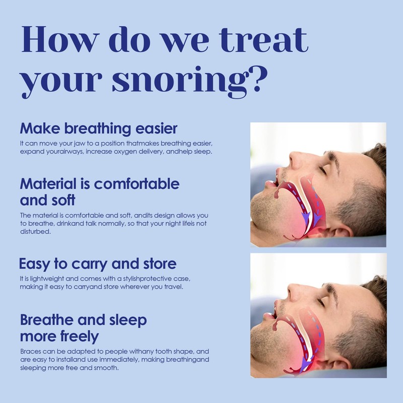 Antischnarchschiene für Anti Schnarch,Schnarchschiene gegen Schnarchen,verbessert die Schlafqualität,für Männer und