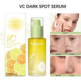2 piezas Green Tangerine Vita C Dark Spot Serum, Suero Antioxidante de Vitamina C, Aclarado y Eliminacion las Manchas, 50ml