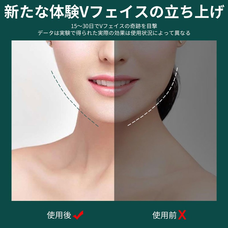 AAGWW Face Line Band Anti Wrinkle Chin Cheek Lifter Small