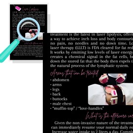 Low Level Laser Lipolysis Info Card | 30 Pack | 4x6" inch Postcard Size | Skin Care | Non-Invasive Laser Lipo | Black and White Design