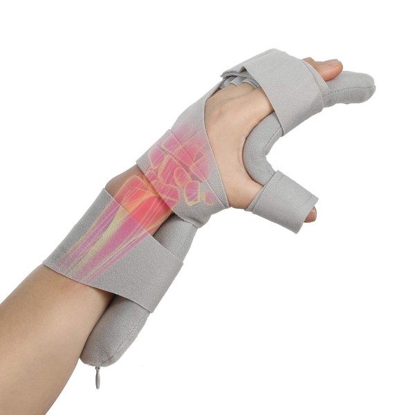 Hand Splint Functional Finger Orthosis Soft Function Resting Hand Splint Fingerboard Night Hand Splint Support Immobiliser for Stroke Hemiplegia (Left)